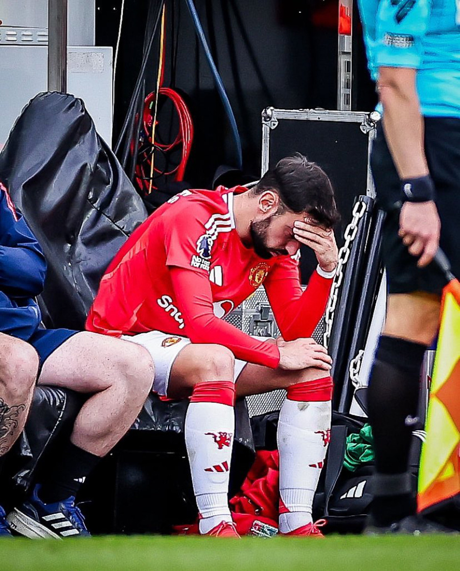 包含曼联年轻球员表现引人瞩目，无缘半决赛的词条